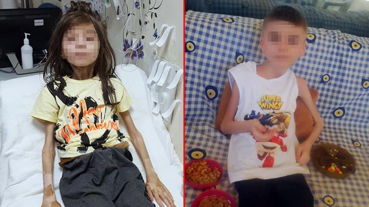 Teyzesinin çöp evde alıkoyduğu Cem Muhammet'ten güzel haberler gelmeye devam ediyor: 20 kiloya ulaştı